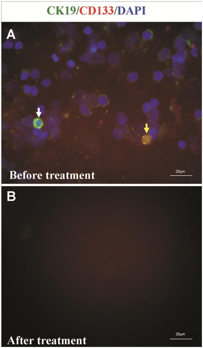 CD133 (Prominin-1) Antibody in Immunocytochemistry (ICC/IF)