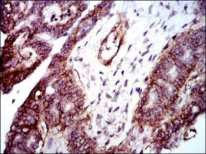 ITGB1 Antibody in Immunohistochemistry (Paraffin) (IHC (P))