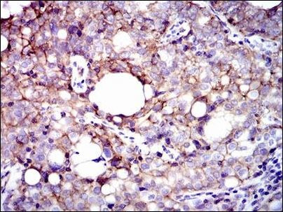 ITGB1 Antibody in Immunohistochemistry (Paraffin) (IHC (P))