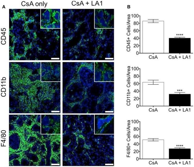 CD45 Antibody in Immunohistochemistry (IHC)