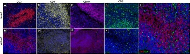 CD4 Antibody in Immunohistochemistry (Paraffin) (IHC (P))