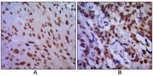 CDK1 Antibody in Immunohistochemistry (Paraffin) (IHC (P))