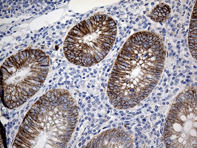 CLEC10A Antibody in Immunohistochemistry (Paraffin) (IHC (P))