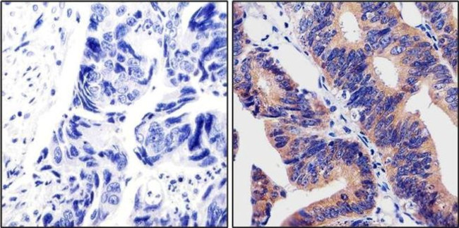 Calpain 1 Antibody in Immunohistochemistry (Paraffin) (IHC (P))