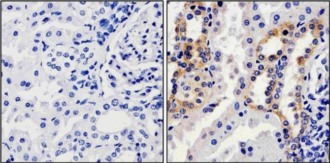 Calpain 1 Antibody in Immunohistochemistry (Paraffin) (IHC (P))