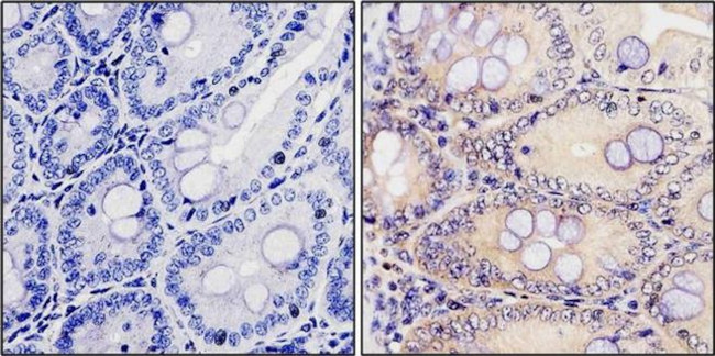 Calpain 1 Antibody in Immunohistochemistry (Paraffin) (IHC (P))