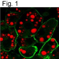 Caveolin 1 Antibody in Immunocytochemistry (ICC/IF)