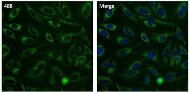 Cytochrome C Antibody in Immunocytochemistry (ICC/IF)