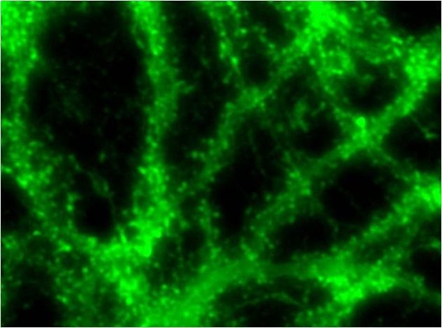 Phalloidin Control in Immunocytochemistry (ICC/IF)