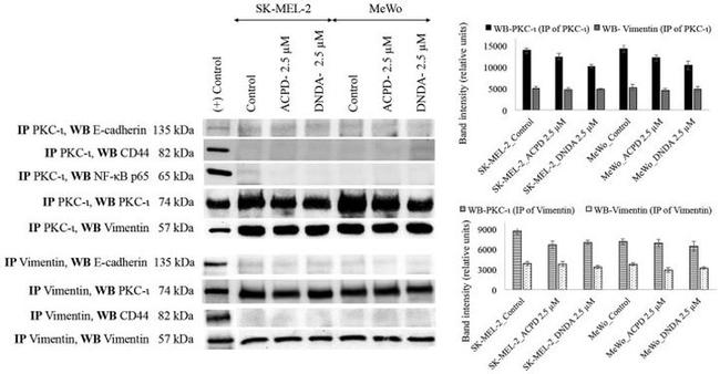 Vimentin Antibody in Western Blot (WB)