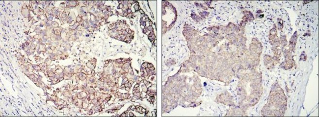 ErbB2 (HER-2) Antibody in Immunohistochemistry (Paraffin) (IHC (P))