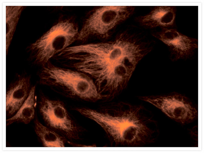 Mouse IgG (H+L) Cross-Adsorbed Secondary Antibody in Immunocytochemistry (ICC/IF)