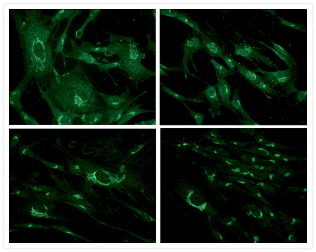 Mouse IgG (H+L) Cross-Adsorbed Secondary Antibody in Immunocytochemistry (ICC/IF)