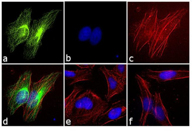 Rabbit IgG (H+L) Cross-Adsorbed Secondary Antibody in Immunocytochemistry (ICC/IF)