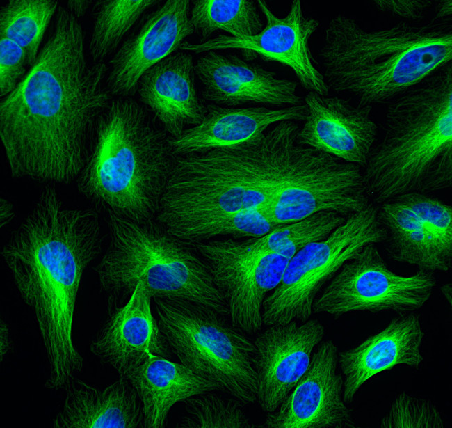 Mouse IgG (H+L) Cross-Adsorbed Secondary Antibody in Immunocytochemistry (ICC/IF)