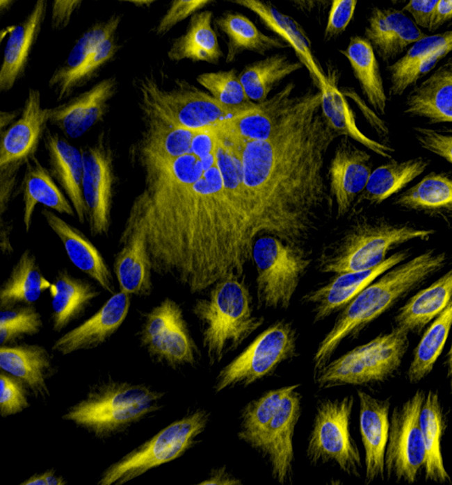 Mouse IgG (H+L) Cross-Adsorbed Secondary Antibody in Immunocytochemistry (ICC/IF)