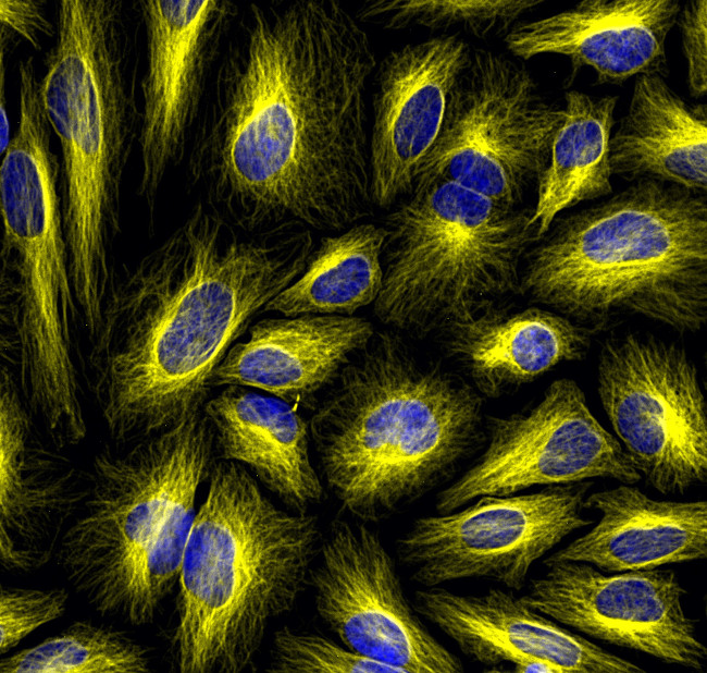 Mouse IgG (H+L) Cross-Adsorbed Secondary Antibody in Immunocytochemistry (ICC/IF)