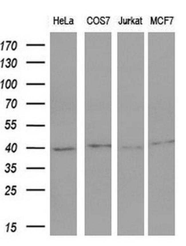 FOS Antibody in Western Blot (WB)