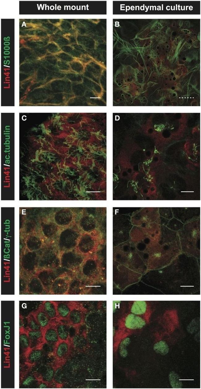 FOXJ1 Antibody in Immunohistochemistry (IHC)