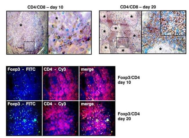 FOXP3 Antibody in Immunohistochemistry (IHC)