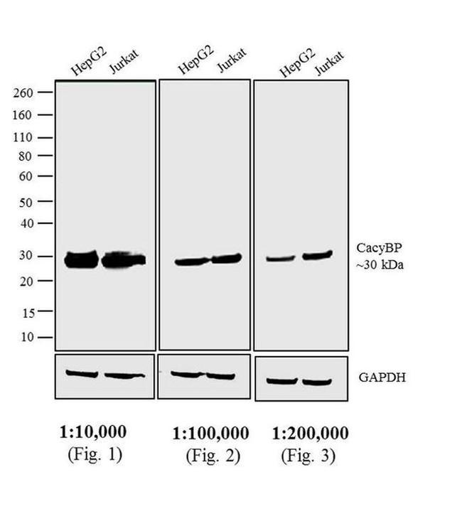 Rabbit IgG (H+L) Cross-Adsorbed Secondary Antibody in Western Blot (WB)