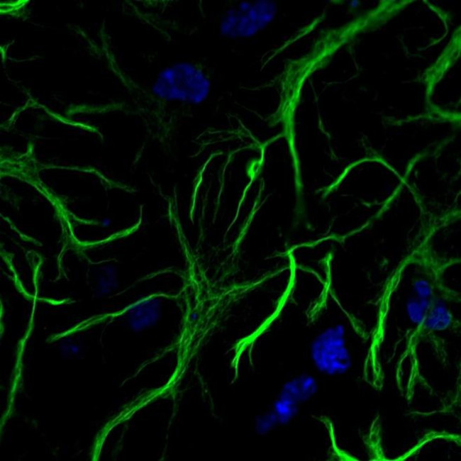 Mouse IgG (H+L) Highly Cross-Adsorbed Secondary Antibody in Immunocytochemistry (ICC/IF)