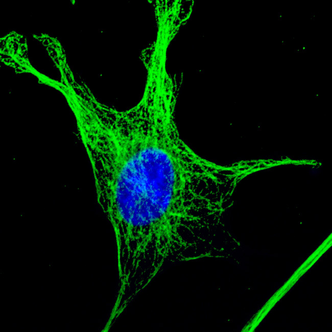 Mouse IgG (H+L) Highly Cross-Adsorbed Secondary Antibody in Immunocytochemistry (ICC/IF)