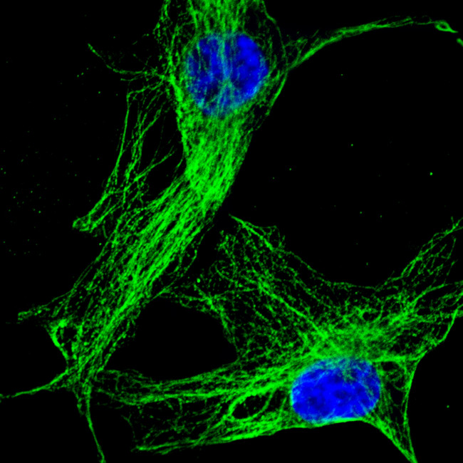 Mouse IgG (H+L) Highly Cross-Adsorbed Secondary Antibody in Immunocytochemistry (ICC/IF)