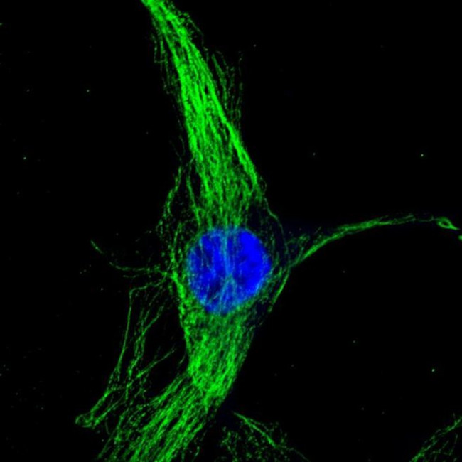 Mouse IgG (H+L) Highly Cross-Adsorbed Secondary Antibody in Immunocytochemistry (ICC/IF)