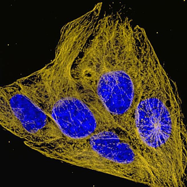 Mouse IgG (H+L) Highly Cross-Adsorbed Secondary Antibody in Immunocytochemistry (ICC/IF)