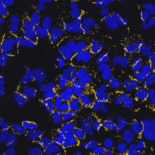 Mouse IgG (H+L) Highly Cross-Adsorbed Secondary Antibody in Immunocytochemistry (ICC/IF)