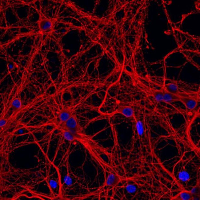 Mouse IgG (H+L) Highly Cross-Adsorbed Secondary Antibody in Immunocytochemistry (ICC/IF)