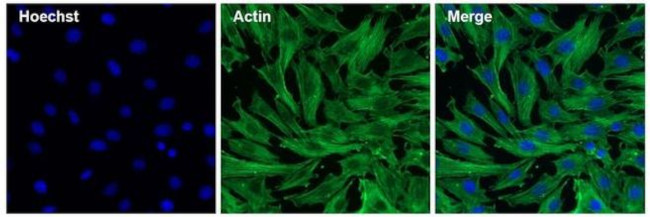 Mouse IgG (H+L) Secondary Antibody in Immunocytochemistry (ICC/IF)