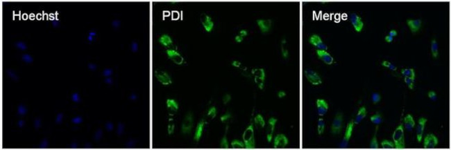 Mouse IgG (H+L) Secondary Antibody in Immunocytochemistry (ICC/IF)