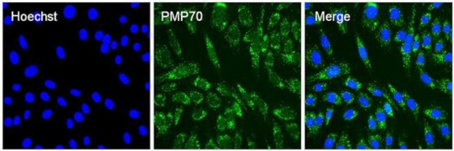 Rabbit IgG (Heavy chain) Secondary Antibody in Immunocytochemistry (ICC/IF)