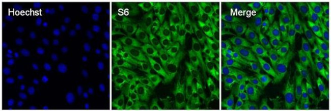 Rabbit IgG (Heavy chain) Secondary Antibody in Immunocytochemistry (ICC/IF)