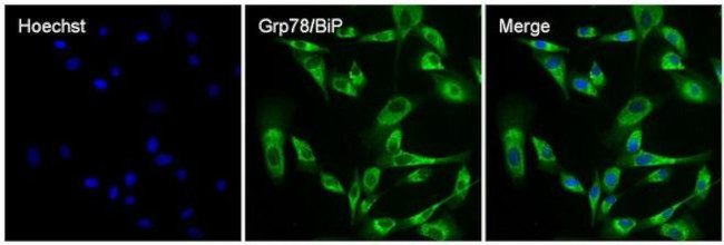 Rabbit IgG (Heavy chain) Secondary Antibody in Immunocytochemistry (ICC/IF)