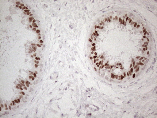 GATA3 Antibody in Immunohistochemistry (Paraffin) (IHC (P))