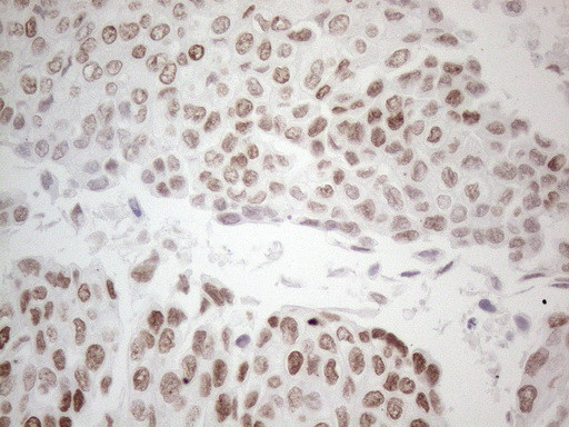 GATA3 Antibody in Immunohistochemistry (Paraffin) (IHC (P))