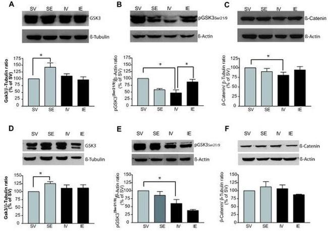 GSK3 alpha/beta Antibody in Western Blot (WB)