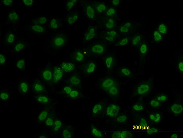 AKT2 Antibody in Immunocytochemistry (ICC/IF)