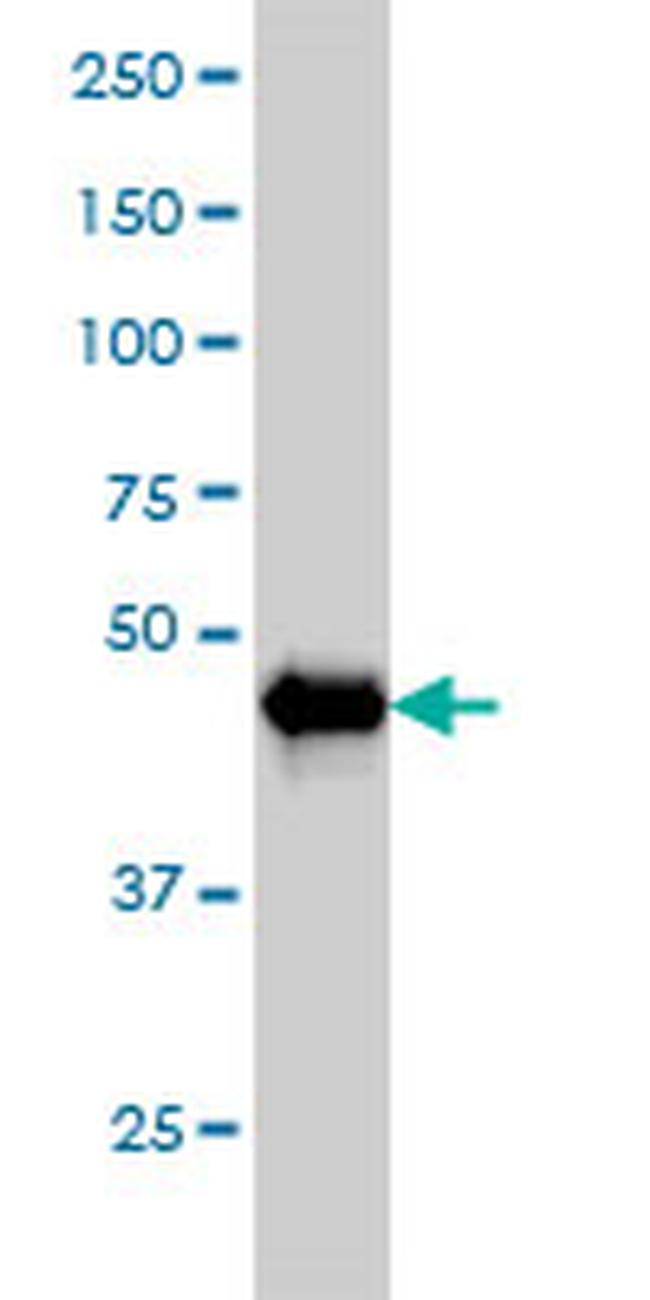 AKT2 Antibody in Western Blot (WB)