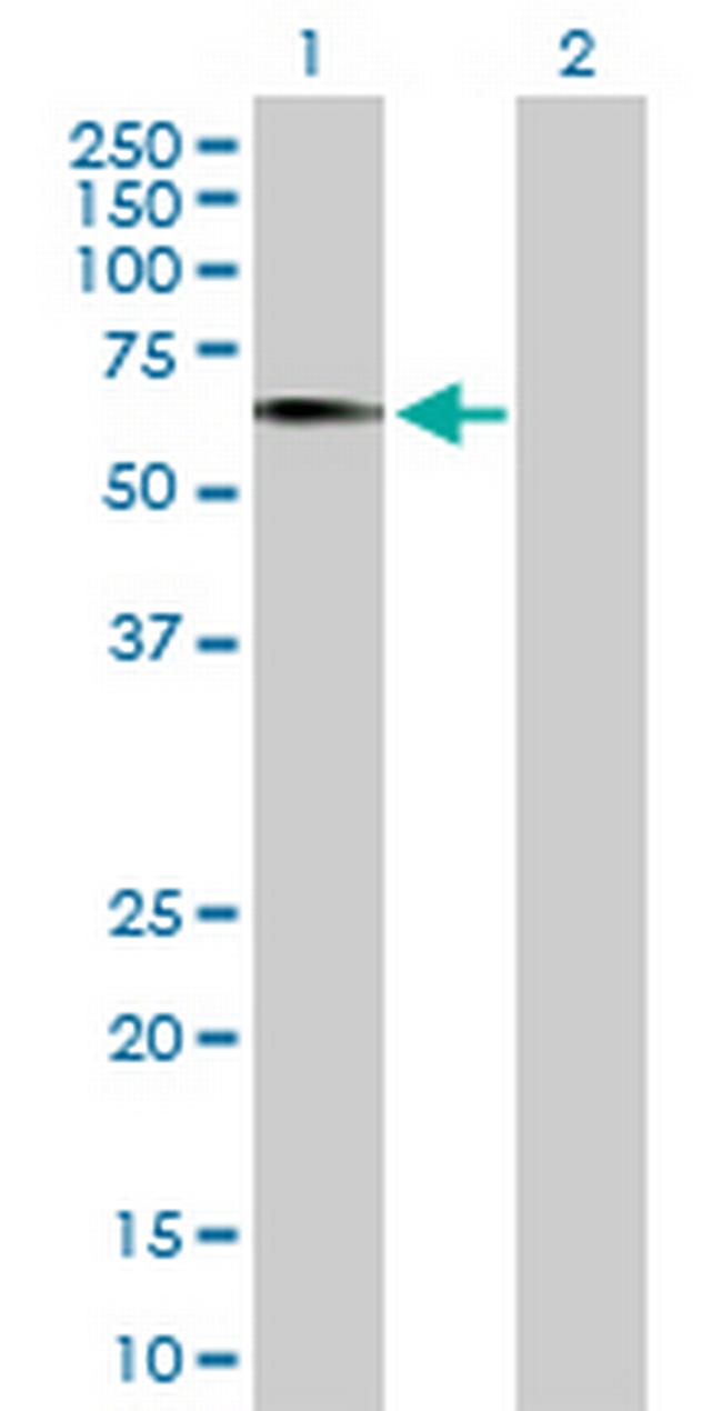 EGR2 Antibody in Western Blot (WB)