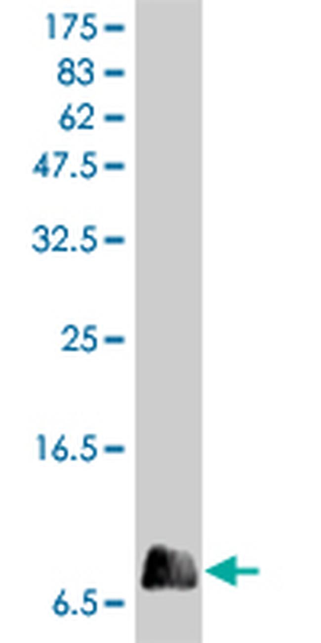 IL8 Antibody in Western Blot (WB)