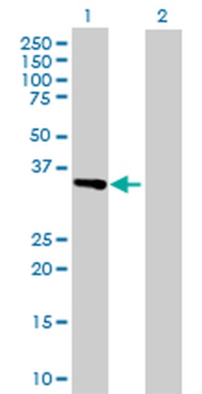 ITGAV Antibody in Western Blot (WB)