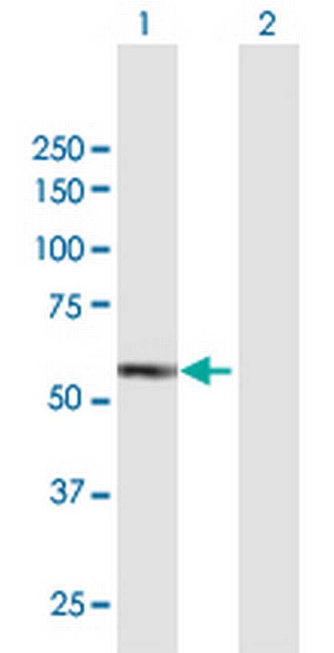 IRAK4 Antibody in Western Blot (WB)