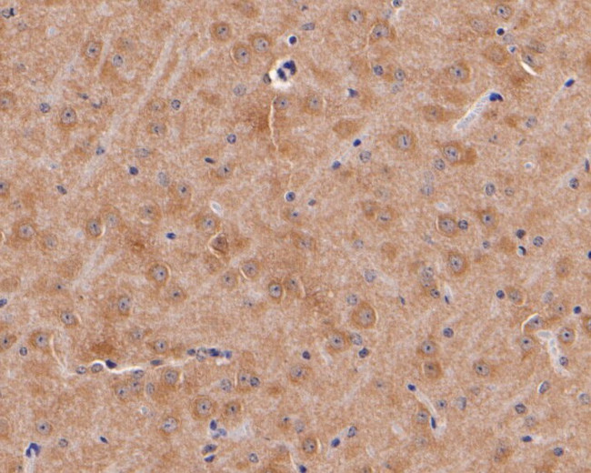 Dopamine Transporter Antibody in Immunohistochemistry (Paraffin) (IHC (P))