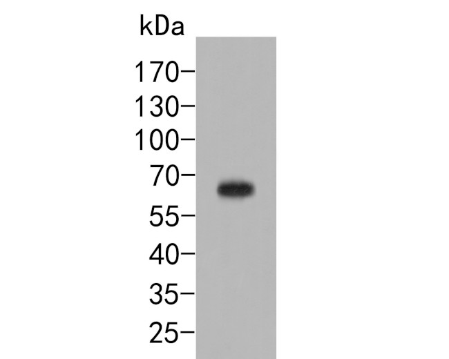 Dopamine Transporter Antibody in Western Blot (WB)