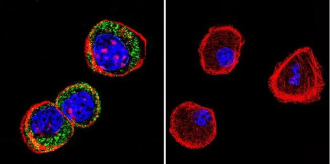 HSP27 Antibody in Immunocytochemistry (ICC/IF)