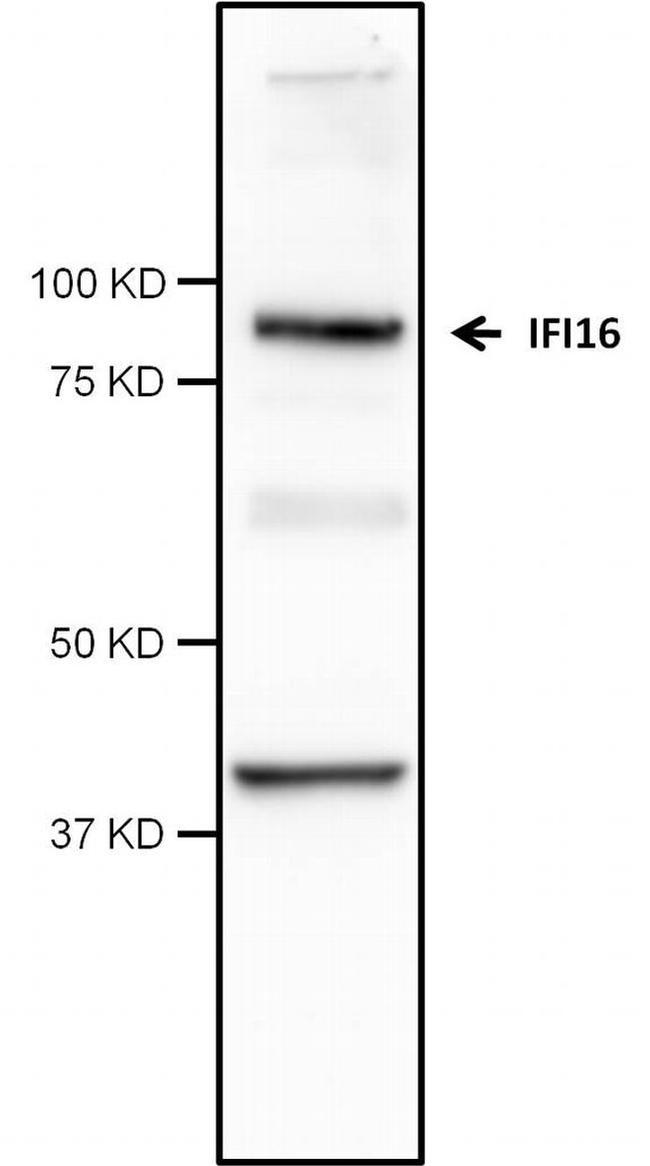 IFI16 Antibody in Western Blot (WB)